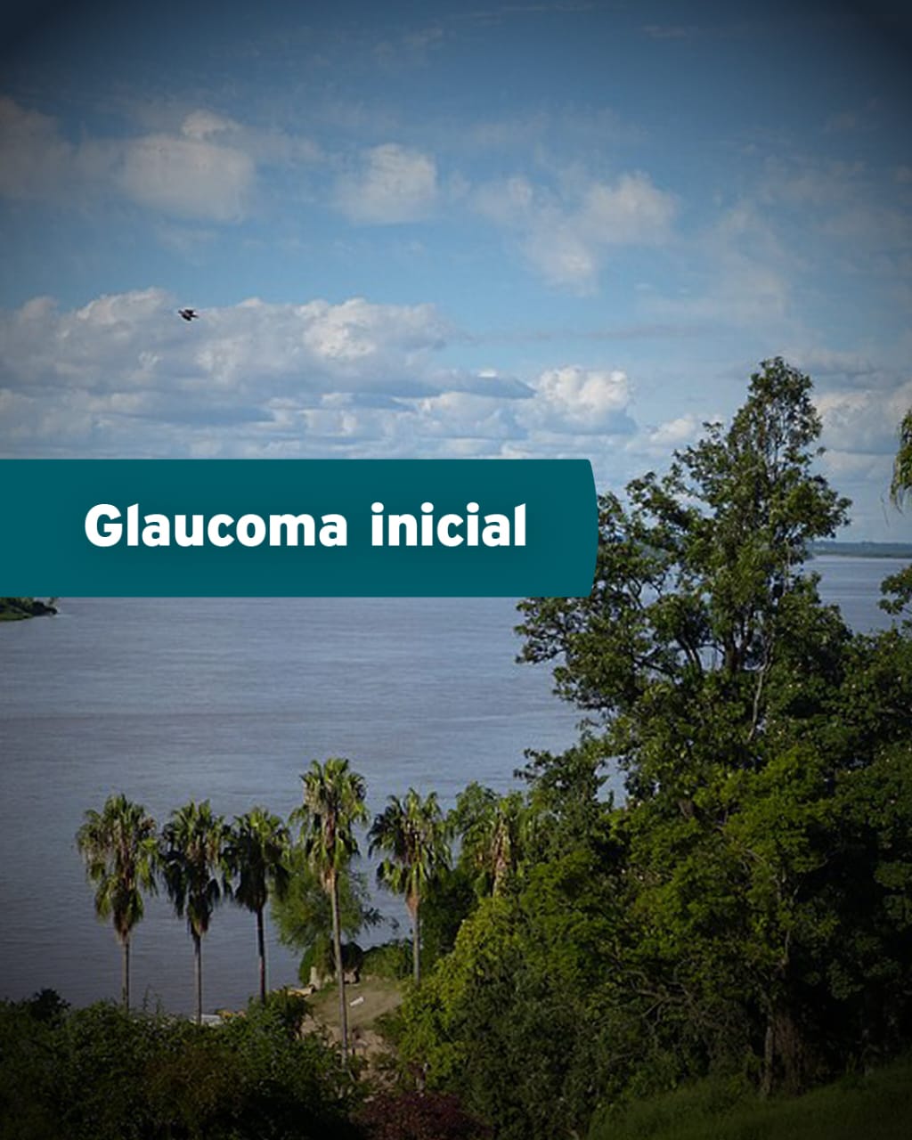 Glaucoma inicial