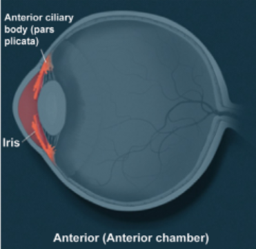 Uveítis anterior